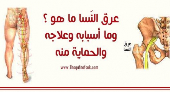 ماهو مرض عرق النسا وماهي اسبابه وعلاجه وكيف تحمي نفسك منه