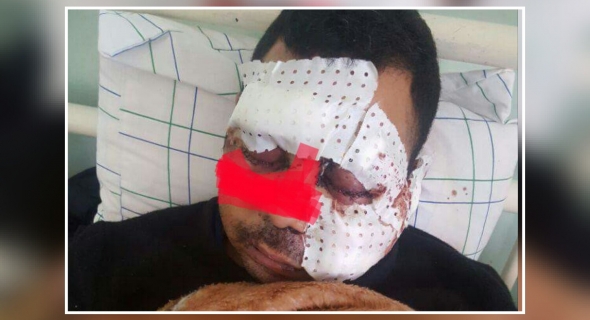السيبة… عصابة بالداخلة تعتدي بالسلاح الأبيض على شاب ينحذر من ضواحي بني ملال وترسله للانعاش -الصورة-