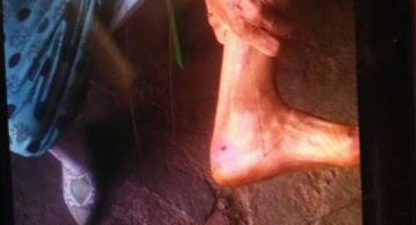 خطير… كلب متوحش يسقط 13 ضحية والسلطات في دار غفلون -الصور-