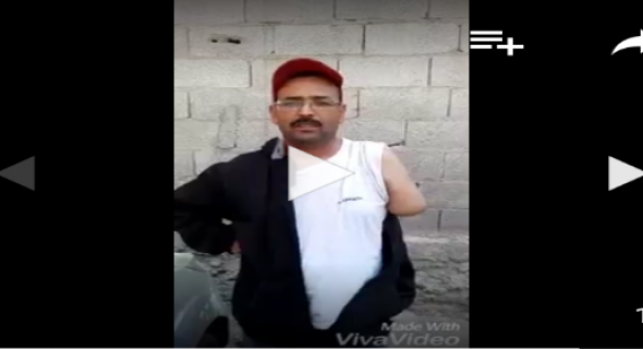 فضيحة… فيديو مؤلم لضحية يحكي كيف بترت يده بسبب جشع مصحة ببني ملال ويناشد الملك والوردي بفتح تحقيق