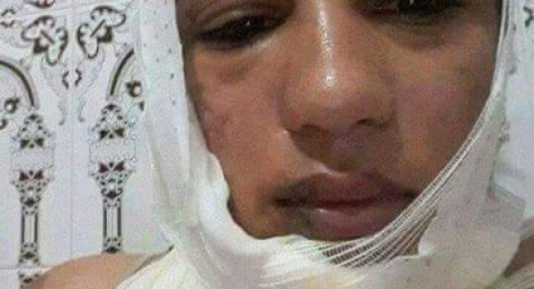 السيبة..شدوها ولاحوها وسط عافية الشعالة والفيسبوك شاعل ويطالب بالقصاص -الصور-