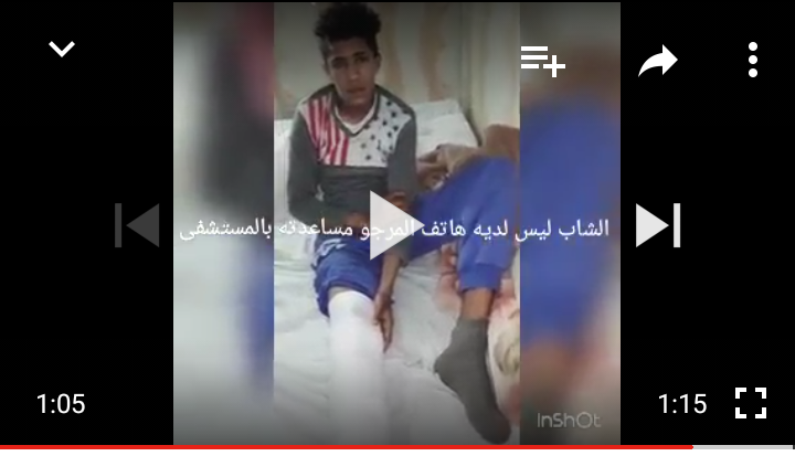فيديو مؤلم لطفل ضحية حادثة سير يوجه نداء للمحسنين لانقاذ ساقه من البتر بمستشفى بني ملال والمبلغ 4000 درهم !