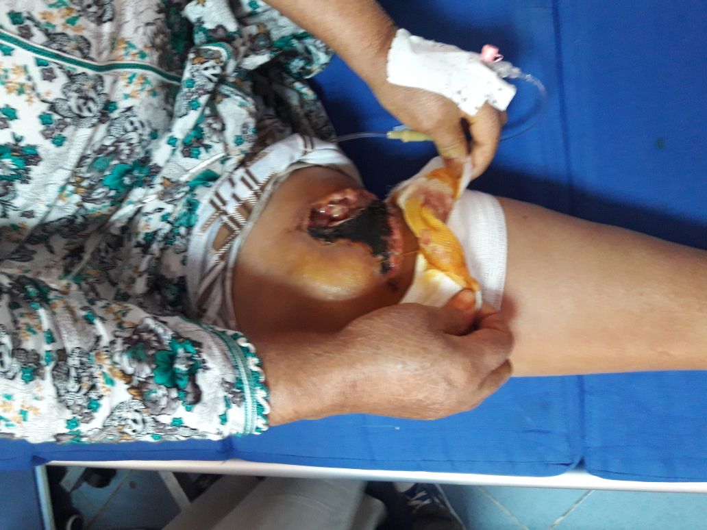 الطبيب الجراح بمستشفى بني ملال ينقد ساق السيدة التي هزت حالتها الرأي العام وهي الان بصحة جيدة وشكر خاص لهؤلاء