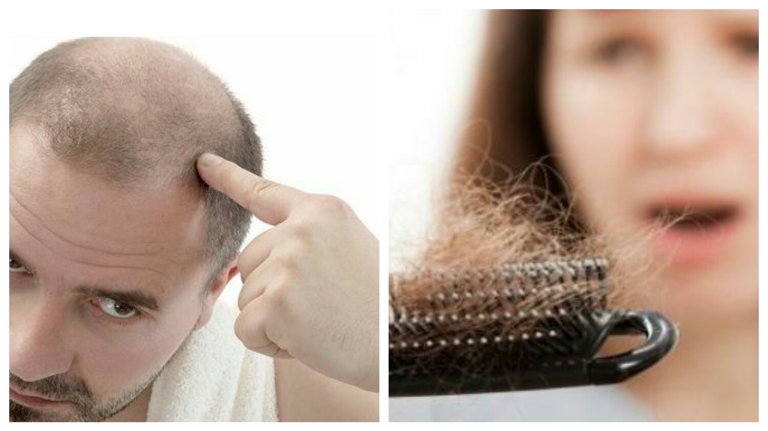 تساقط الشعر عند النساء والرجال… الأسباب والعلاج