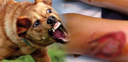 عاجل…. الكلاب الضالة تهاجم المواطنين و ترسل 6 حالات لمستعجلات بني ملال