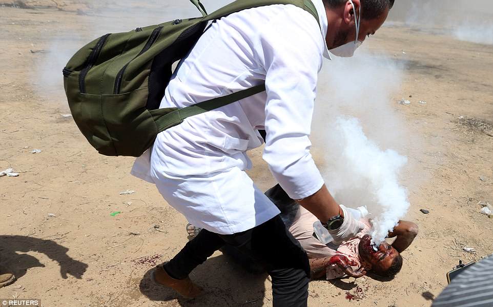 صور مؤلمة بزاف… عبوة غاز إسرائيلية تنفجر في وجه فلسطيني وخروج الغاز من فمه وأنفه