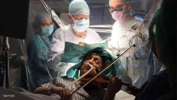 مريضة تعزف الكمان أثناء الخضوع لجراحة بالمخ ببريطانيا