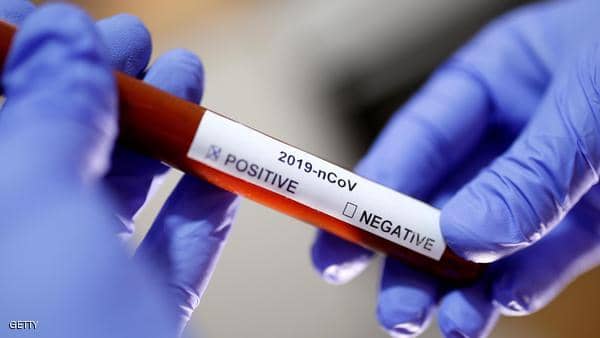 خبر سار… أطباء روسيا يتوصلون للقاح ضد “كورونا” نجح في اختباره على البشر