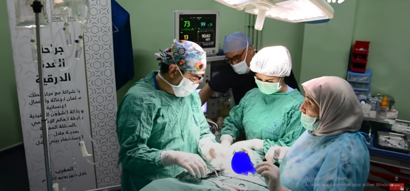هذي مزيانة… أطباء مغاربة وسعوديون يجرون عمليات جراحية لاستئصال وإزالة الغدة الدرقية لفائدة 83 مريض ومريضة بالمستشفى الجهوي ببني ملال