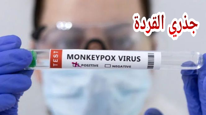 الله يلطف تاني… رسميا وزارة الصحة تعلن عن تسجيل حالة مؤكدة بفيروس جذري القردة بالمغرب