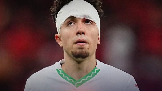 النجم المغربي العيناوي يتعرض لسرقة مبالغ مالية كبيرة وساعة فاخرة داخل منزله (صحف إيطالية)