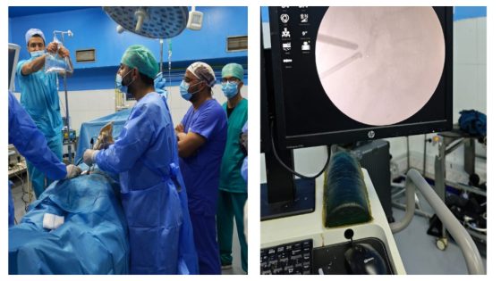 سابقة طبية ببني ملال وبرافو عليهم… لأول مرة أطباء بالمستشفى الجهوي العمومي يجرون جراحة تنظيرية متطورة لعلاج الفتق بين الفقرات